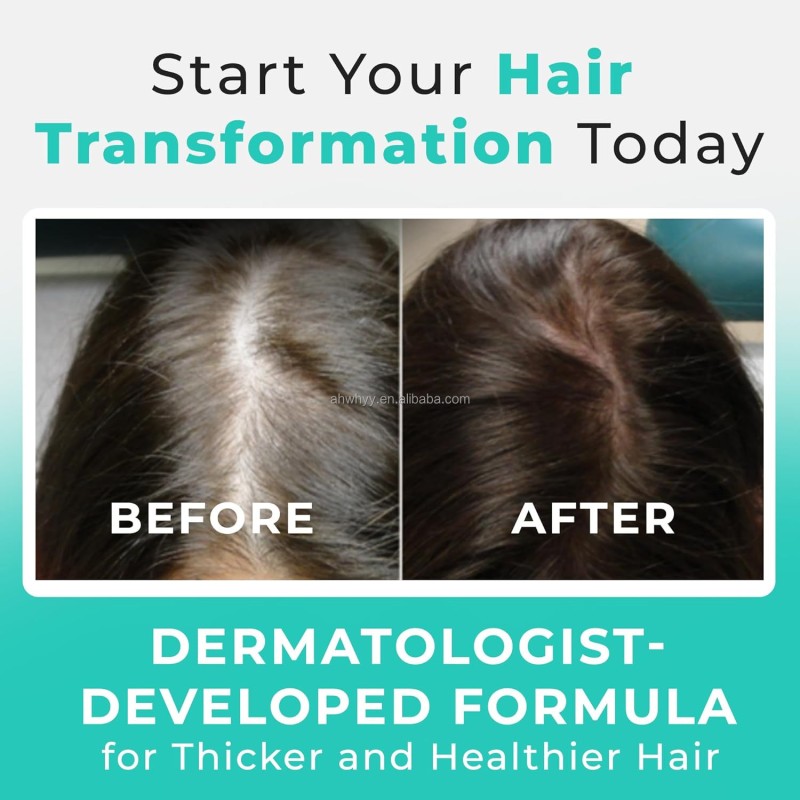 Capsules for Hair Growth Vitamins Capsules Hair Growth Capsule Supplement