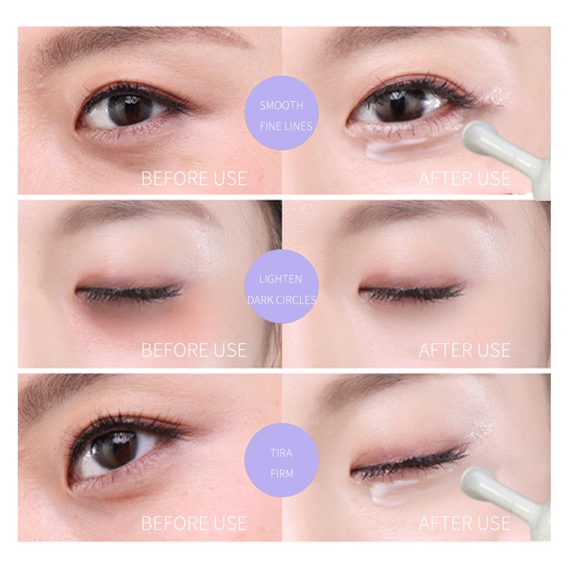 Anti Aging Eye Cream Factory - Private Label Reduce Wrinkles Fine Lines Lifting Firming Vegan