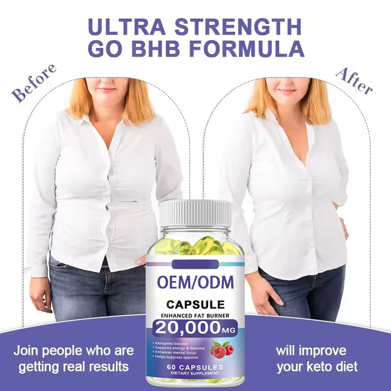 Keto Softgels Supplier - OEM Weight Loss Fat Management