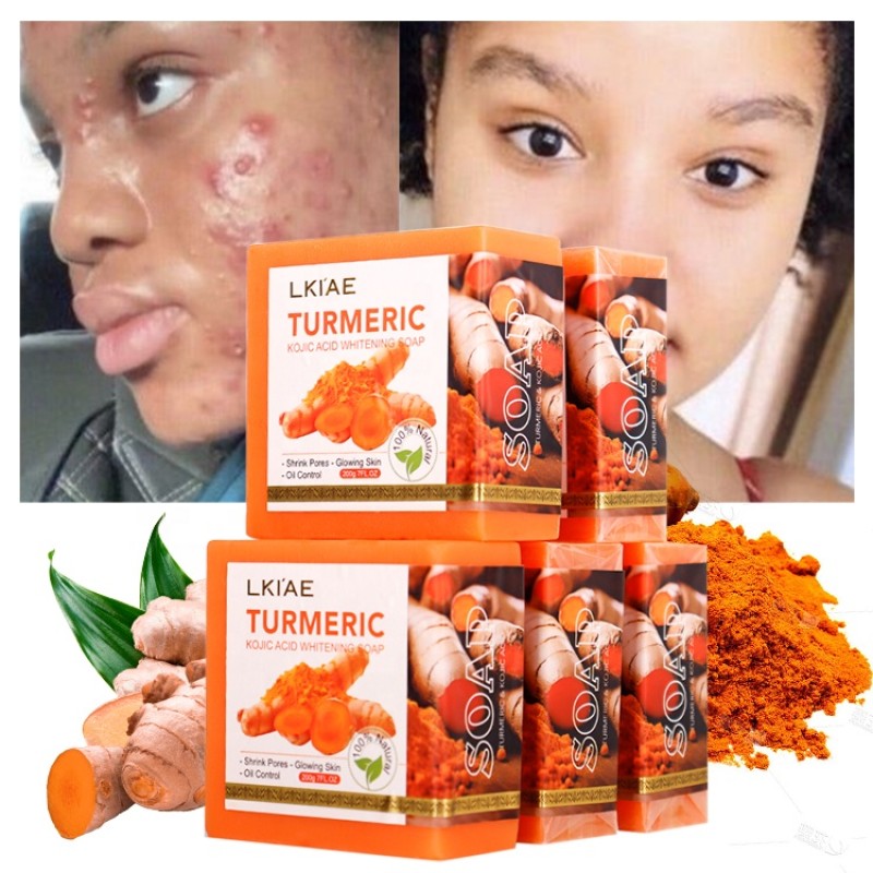 Turmeric Soap Factory - OEM Acne Removal Brightening Bar