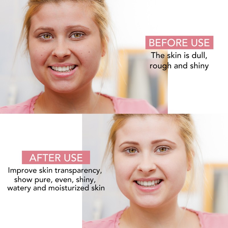 Sleeping Mask Manufacturer - OEM Kojic Acid Brightening Hydrating