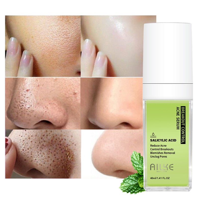 Face Serum Factory - OEM Salycilic Acid Acne Inhibit