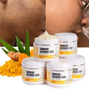 Turmeric Cream Manufacturer - OEM Oily Skin Blemish Removal