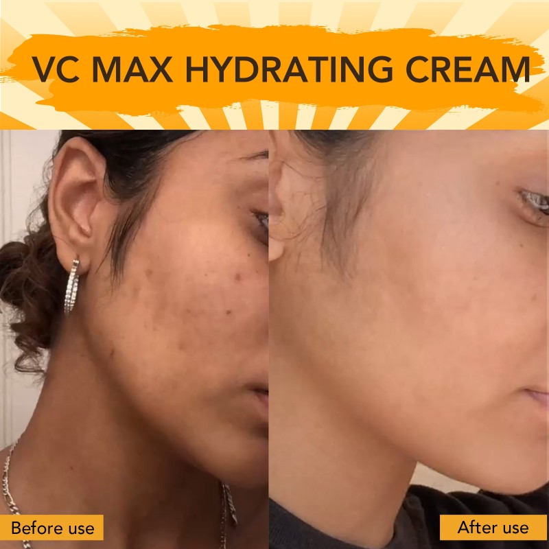 Face Cream Factory - OEM Vitamin C Hydrating African Skin