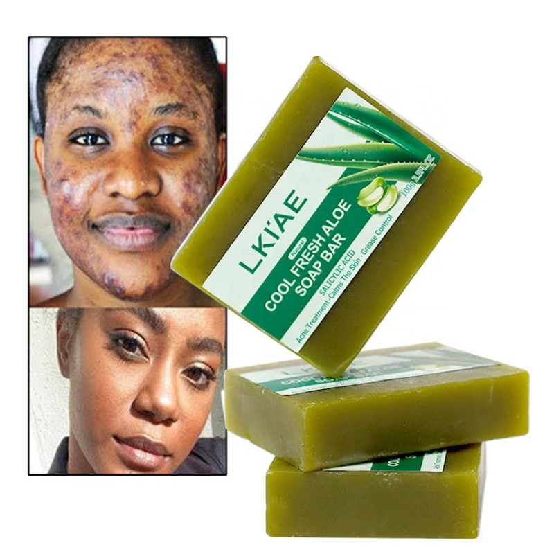 Kojic Acid Soap Factory - OEM Natural Brightening Acne Remover Soap