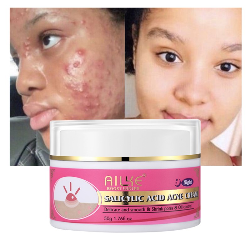 Acne Cream Factory - OEM Salicylic Acid Dark Spot Remover