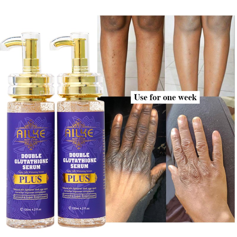 Whitening Serum Manufacturer - OEM Dark Spot Corrector For Black Skin