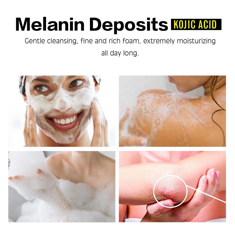 Kojic Acid Soap Factory - OEM Natural Bleaching Hyperpigmentation