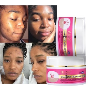 Face Cream Factory - OEM Anti Acne Pimple Removing Lightening