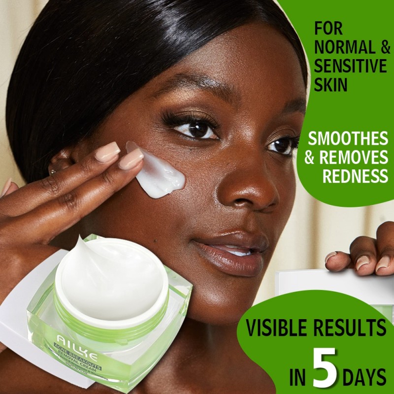 Acne Cream Factory - OEM Salicylic Acid Whitehead Remover