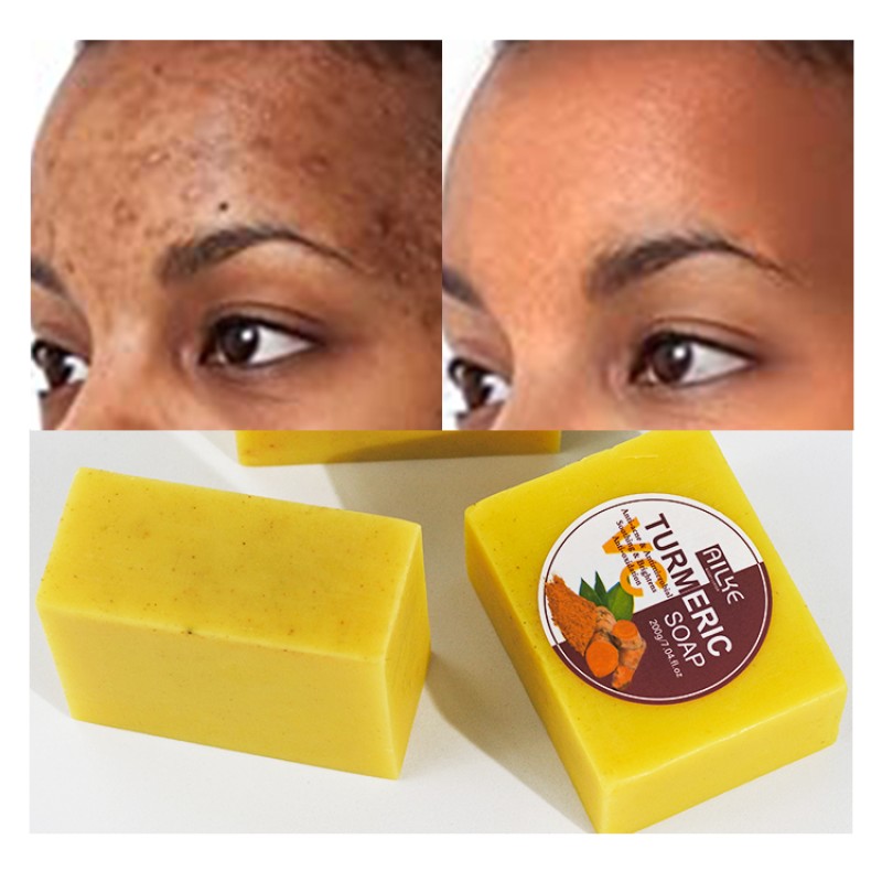 Acne Soap Manufacturer - OEM Turmeric Scrub Dark Spot Removal