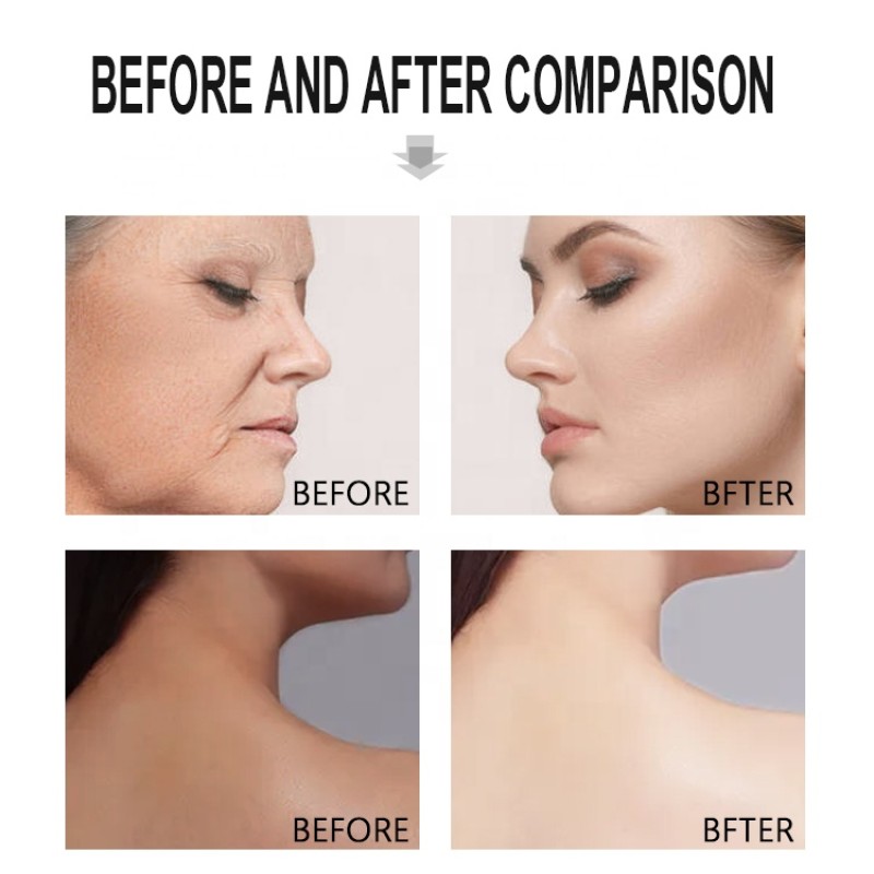 Face Serum Manufacturer - OEM Collagen Kojic Acid Whitening