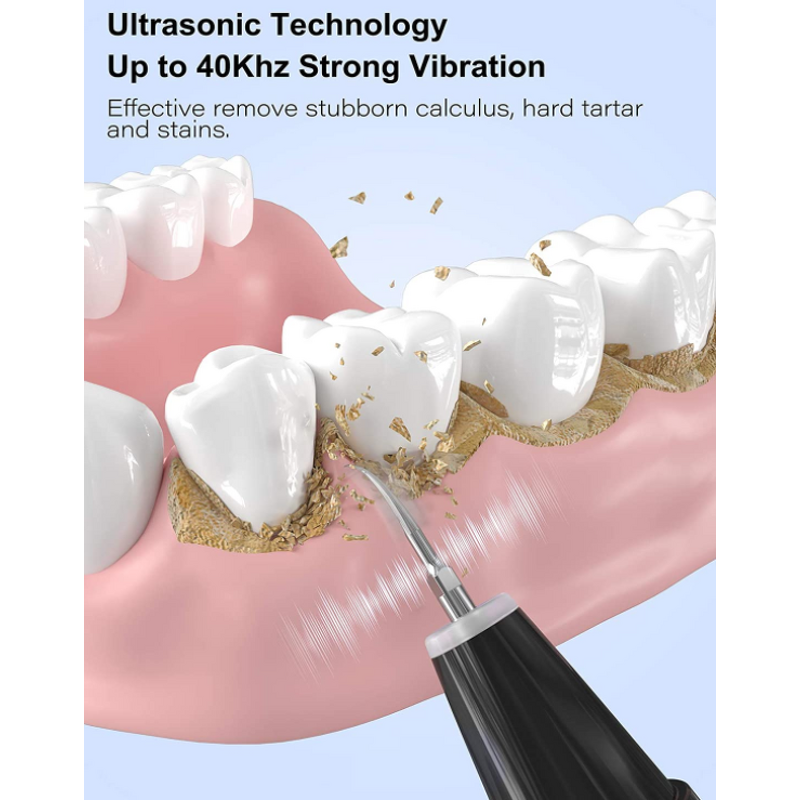 Ultrasonic Tooth Cleaner - Electric Tartar Stains Removal Oral Cleaning Machine