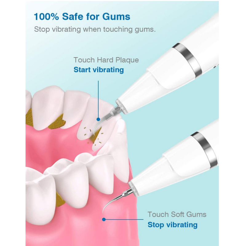 Ultrasonic Tooth Cleaner - Electric Tartar Stains Removal Oral Cleaning Machine