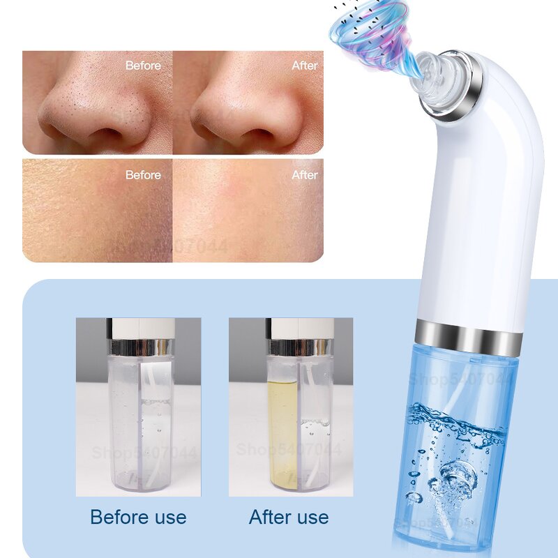 USB Blackhead Remover - Rechargeable Vacuum Pore Cleaner Skin Care Tool