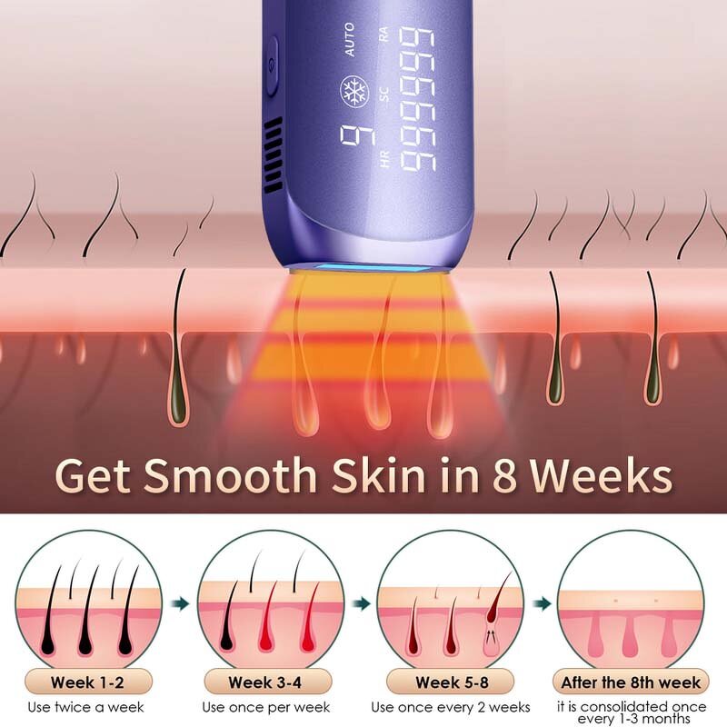 5-in-1 Women's Epilator - Rechargeable Cordless Facial Body Hair Remover