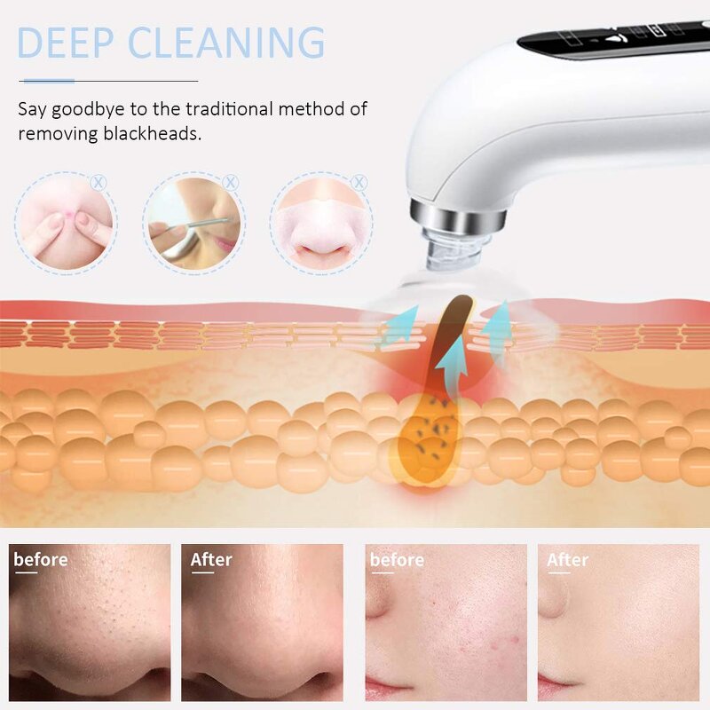 USB Blackhead Remover - Rechargeable Vacuum Pore Cleaner Skin Care Tool