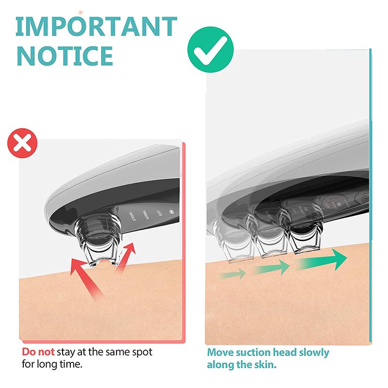 Pore Cleaner Manufacturer - Electric with 42-55kPa Suction Power & 3 Intensity Levels