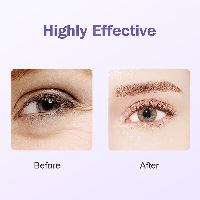 Eye Massager Manufacturer - Portable Mini Electric EMS with Anti-aging Light Therapy