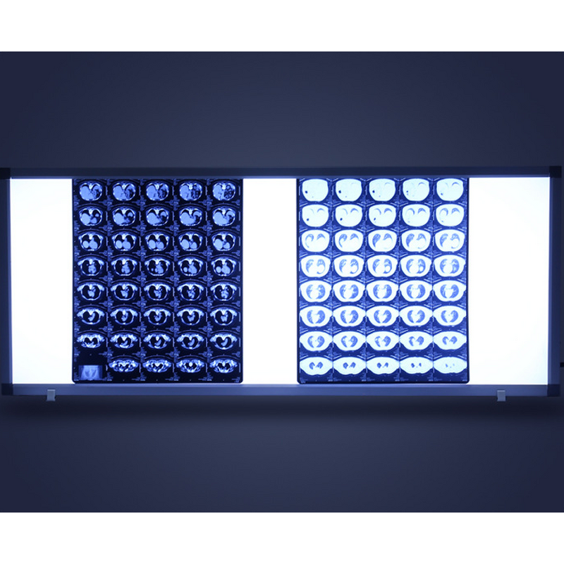 X-ray Film Viewer - Electric Hospital LED Light Box Single/Double/Triple for Orthopedic