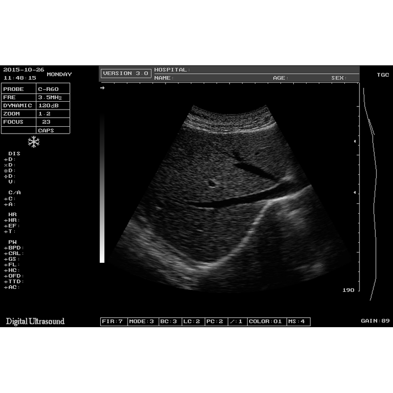 Laptop Ultrasound Machine - 12.1 Inch Hospital Equipment Medical Scanner Device