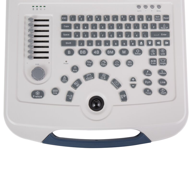 Laptop Ultrasound Machine - 12.1 Inch HD LCD Medical Ultrasonic Diagnostic System