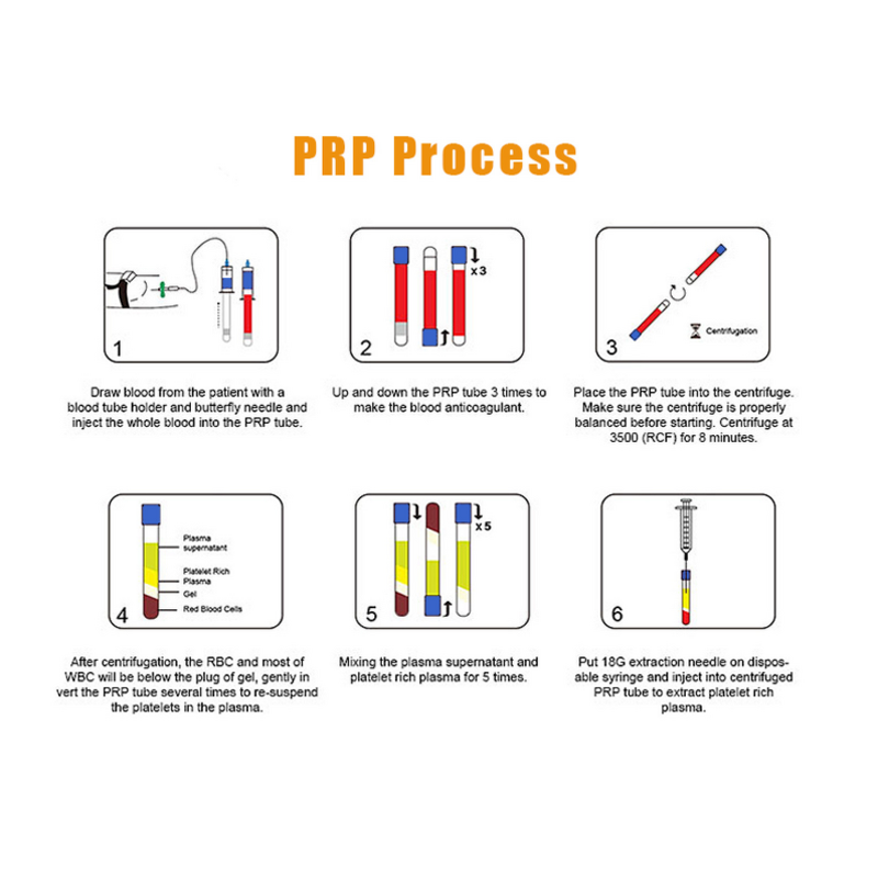 PRP Extraction Tube - Beauty 10ml with ACD Separation Glue Platelet-Rich Plasma