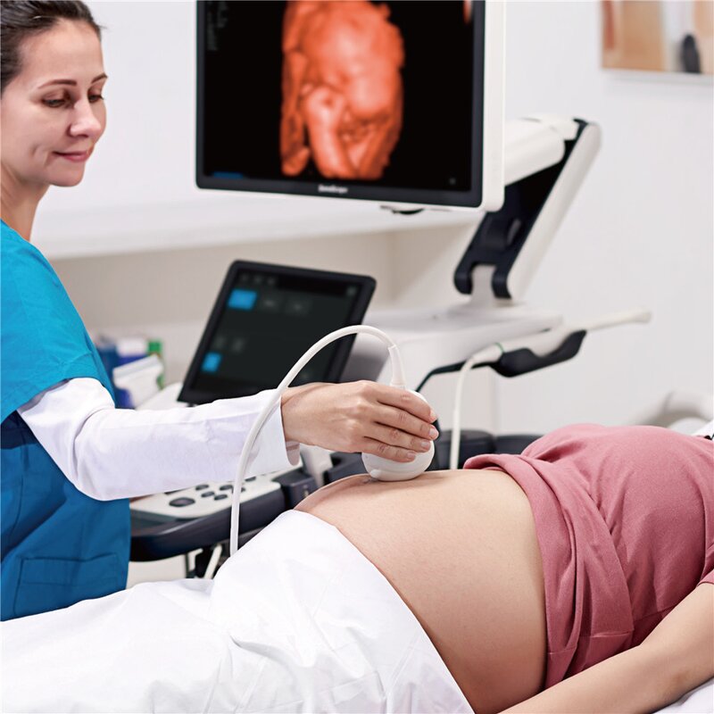 Vascular Ultrasound Machine - High Technology 3D/4D Siterite Site-rite Color Trolley Sonoscape S60