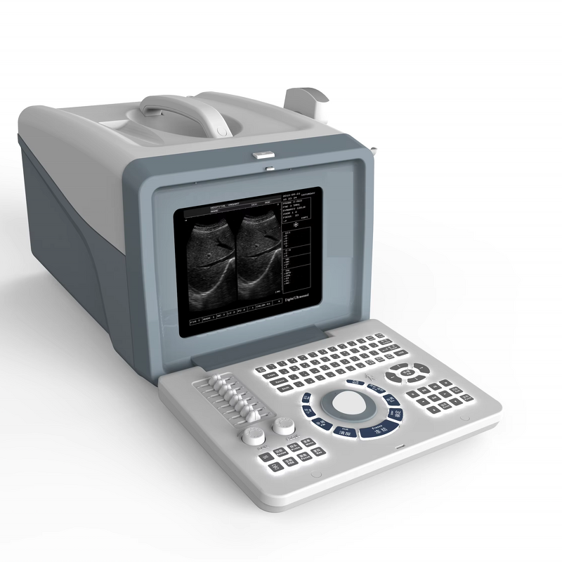 Handheld Ultrasound Machine - Hospital Equipment Cheapest Medical Scanner Device