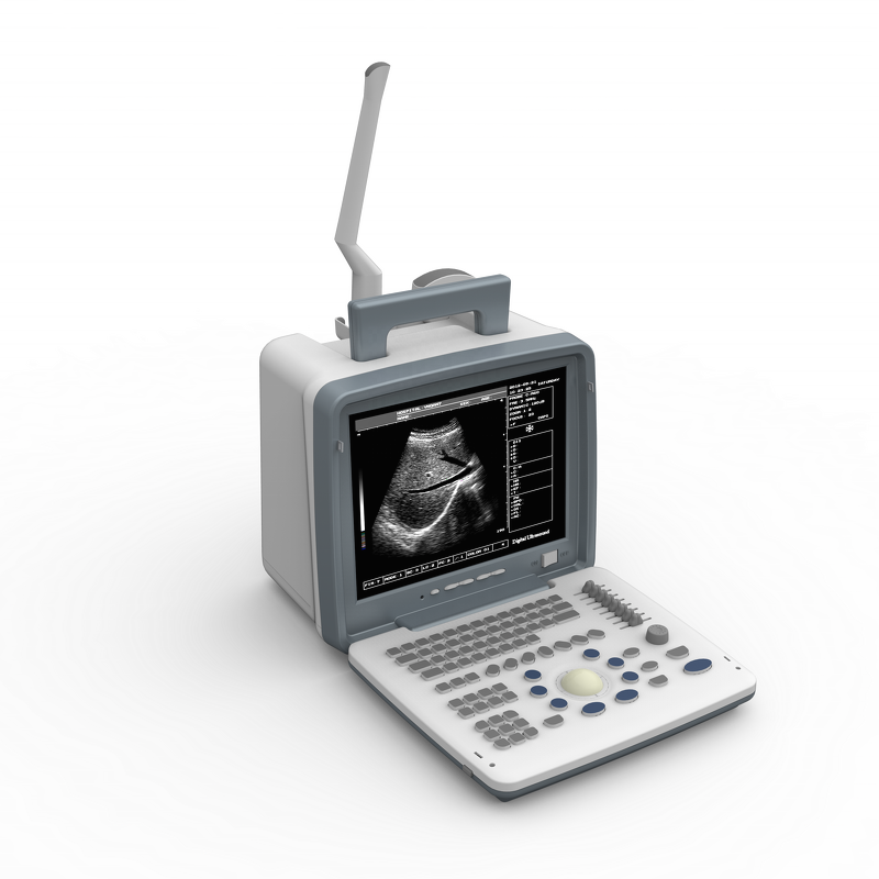 Portable Ultrasound Machine - S300 Digital B-mode Ultrasonography Scanner Price