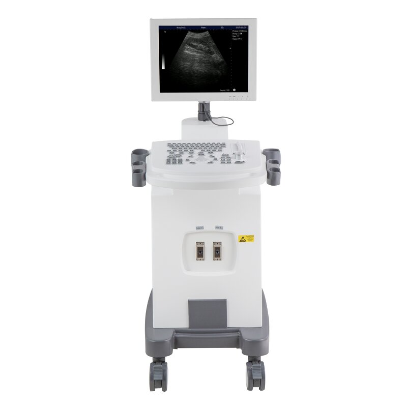Mobile Ultrasound Machine - 15 Inch LED Screen for Physical Therapy Digital Scan