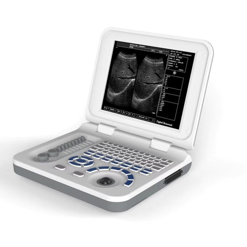 Laptop Ultrasound Machine - 10.4 Inch Hospital Equipment Cheapest Medical Scanner