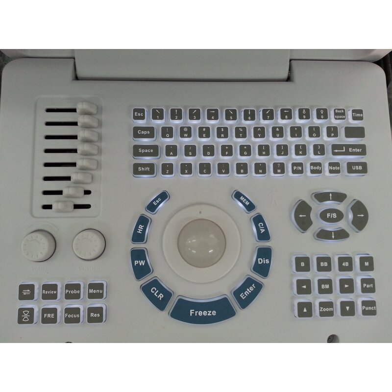 Handheld Ultrasound Machine - Hospital Equipment Cheapest Medical Scanner Device