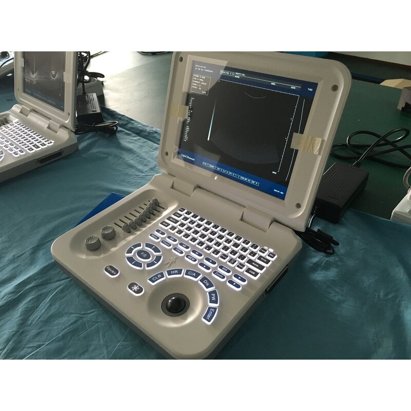 Laptop Ultrasound Machine - 10.4 Inch Hospital Equipment Cheapest Medical Scanner