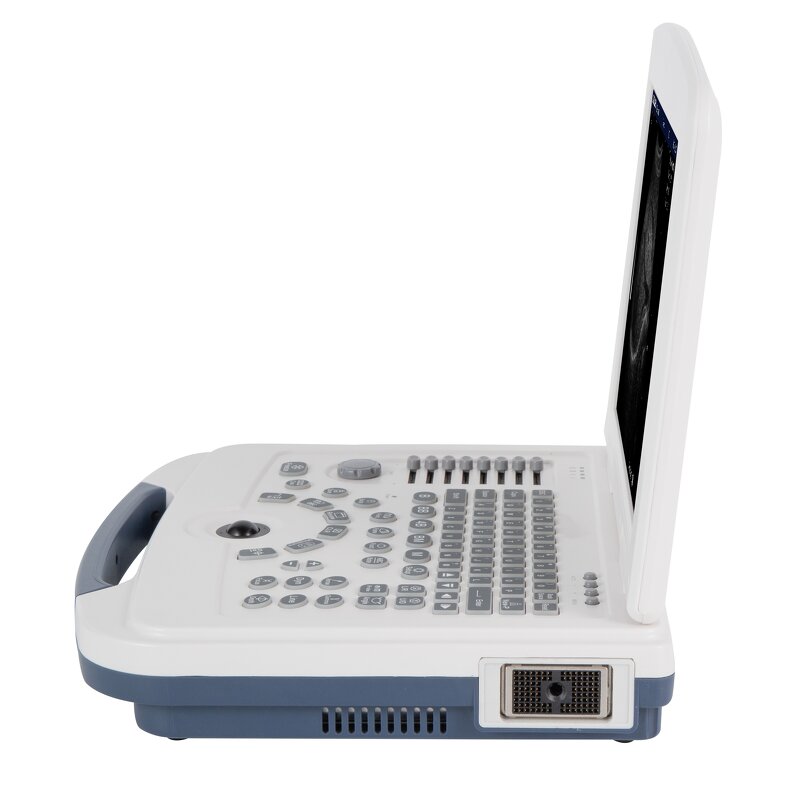 Laptop Ultrasound Machine - 12.1 Inch HD LCD Medical Ultrasonic Diagnostic System