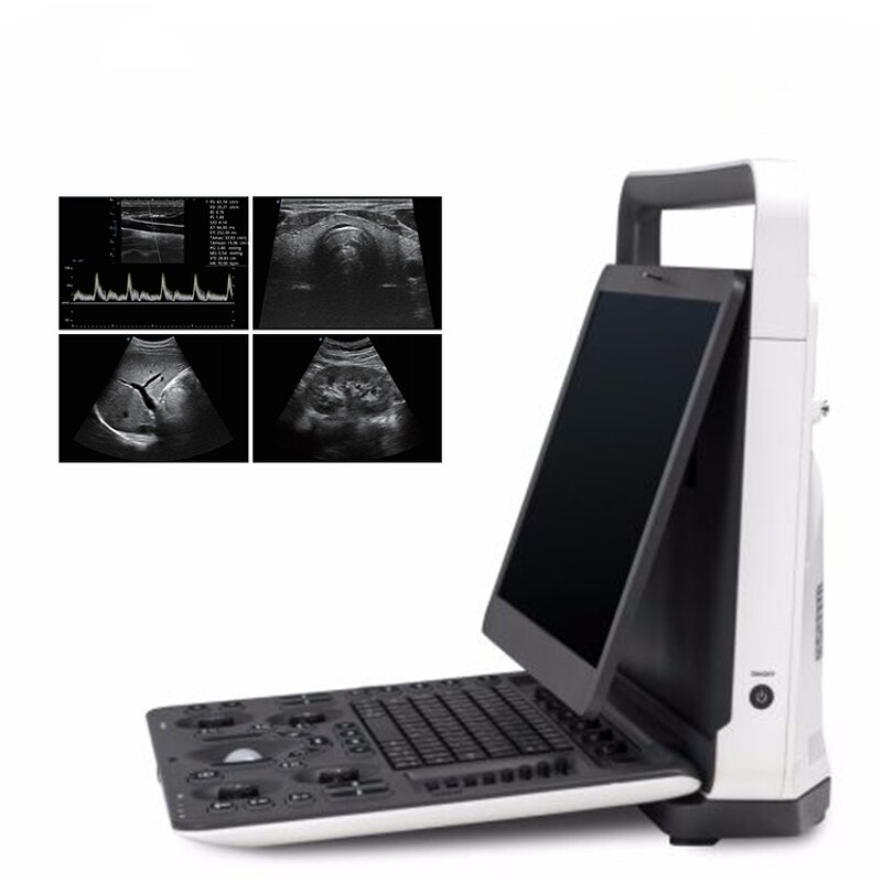 Portable Ultrasound Machine - Cheaper 3D 4D 15" High Resolution Laptop Echo Machine