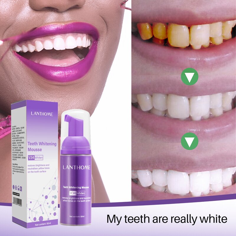 Teeth Whitening Mousse - Removes Smoke Stains Freshens Breath Yellow Teeth Care