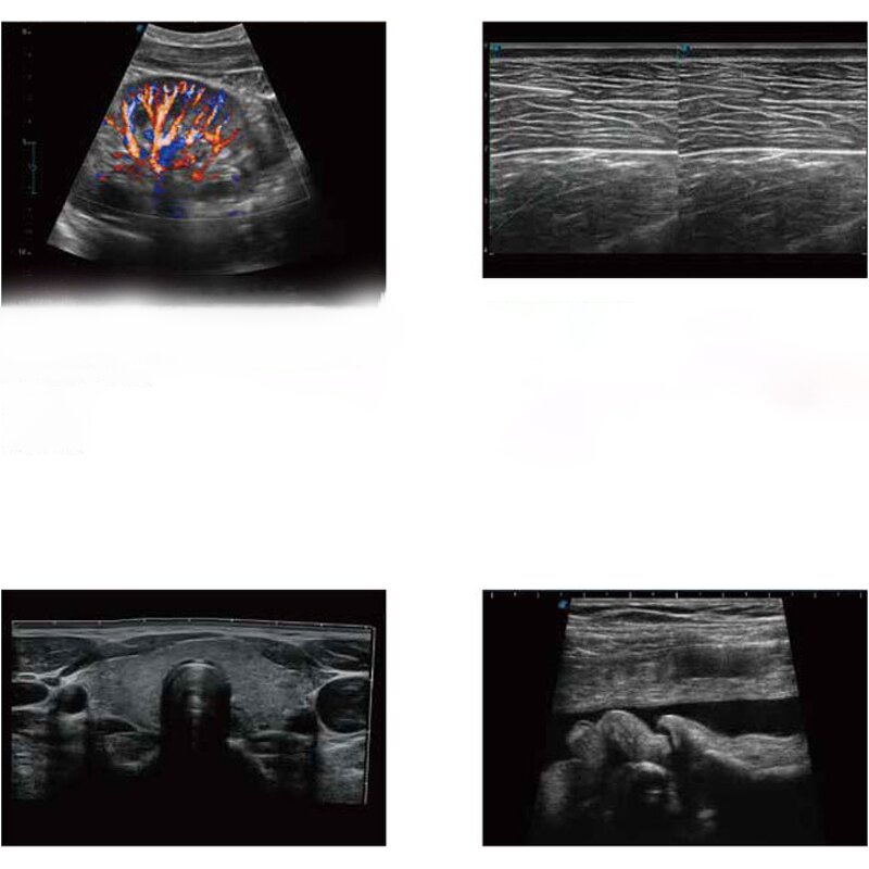 Ultrasound Probe - Healson C30C Acrylic Electric Handheld Convex Multi-Purpose