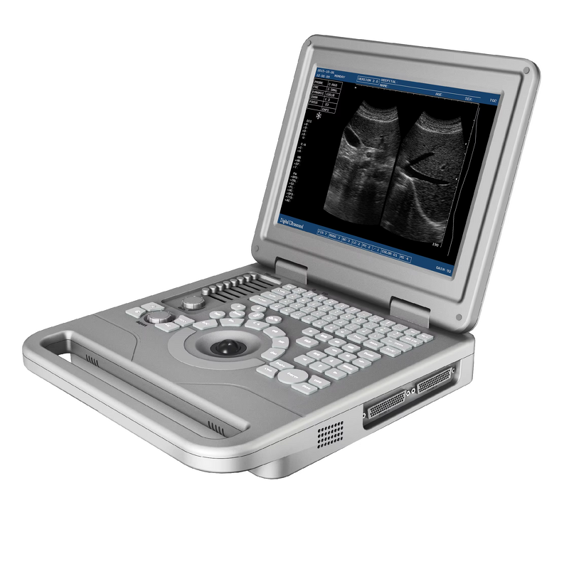 Laptop Ultrasound Machine - 12.1 Inch Hospital Equipment Medical Scanner Device