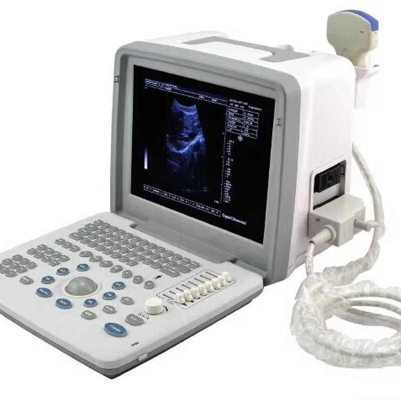 Portable Ultrasound Machine - S300 Digital B-mode Ultrasonography Scanner Price