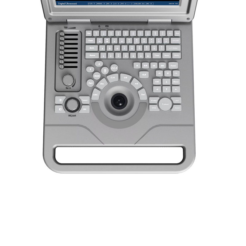 Laptop Ultrasound Machine - 12.1 Inch Hospital Equipment Medical Scanner Device