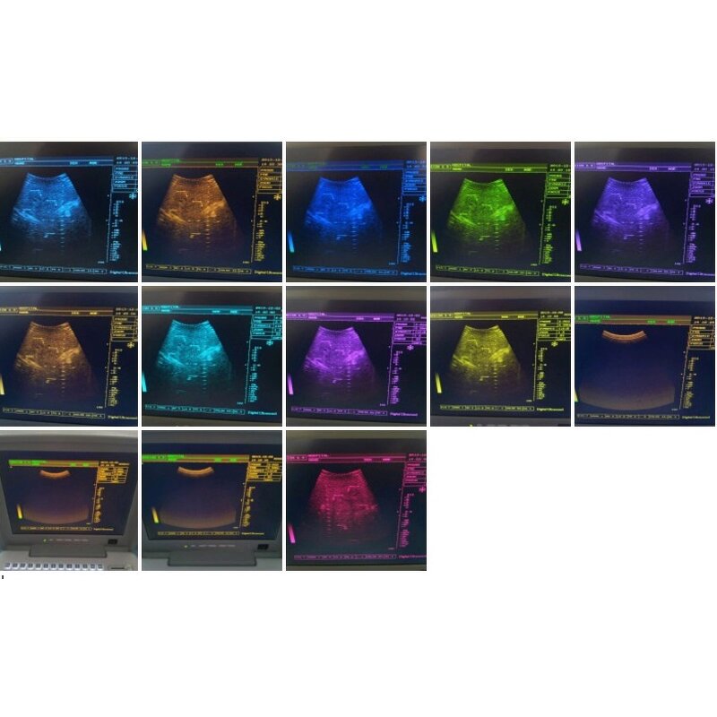 Portable Ultrasound Machine - S300 Digital B-mode Ultrasonography Scanner Price