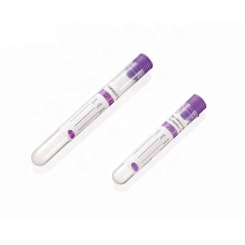 Vacuum Blood Collection Tube - China Wholesale Hospital Use Medical Disposable NAT Tube