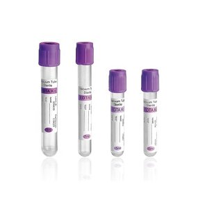 Vacuum Blood Collection Tube - China Wholesale Hospital Use Medical Disposable NAT Tube