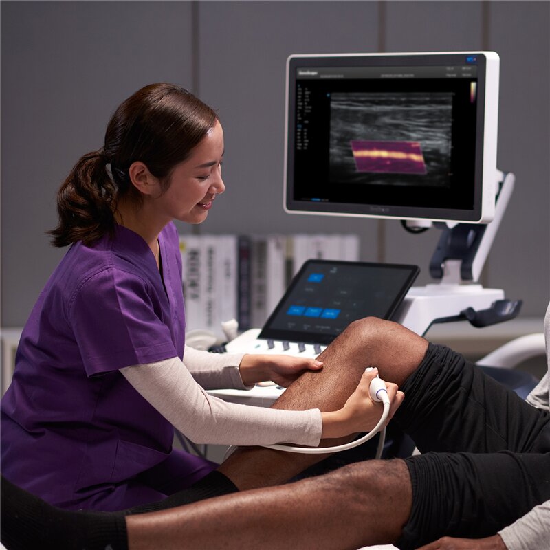 Vascular Ultrasound Machine - High Technology 3D/4D Siterite Site-rite Color Trolley Sonoscape S60