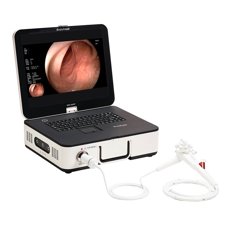 Endoscope Imaging System - Medical Equipment Camera Laparoscope Gastroscope