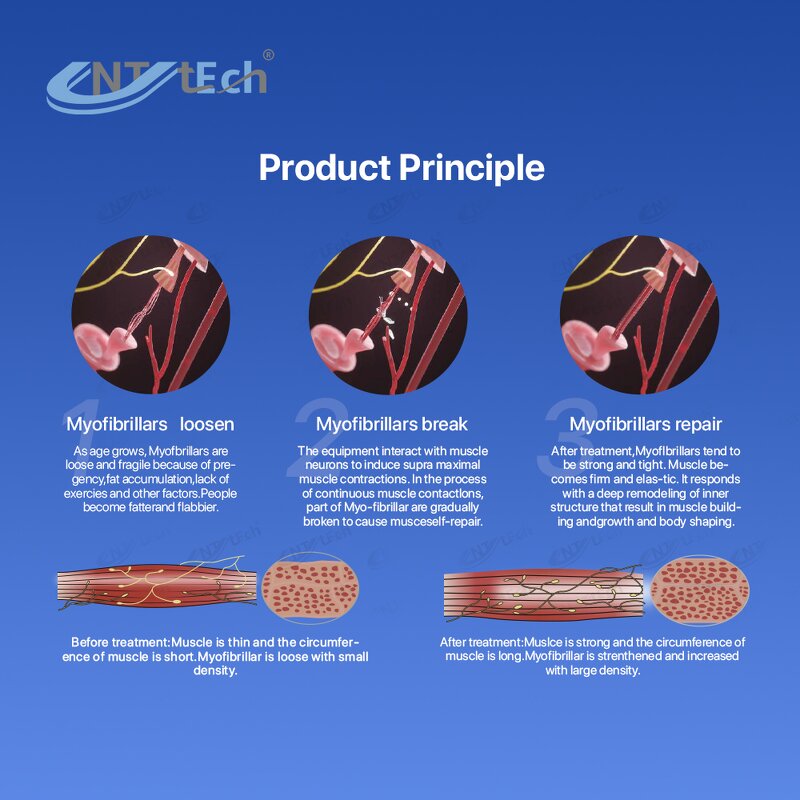 EMS RF Sculpting Machine - Beijing Unt 15 tesla Rf with Pelvic 2023 Device