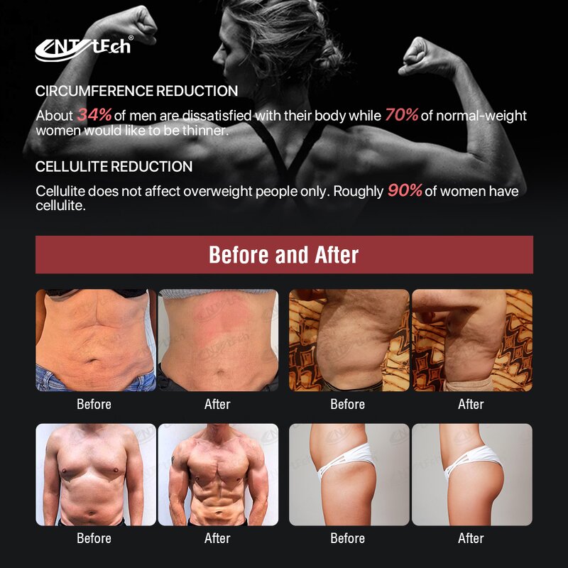 EMS RF Slim Machine - New Arrival 4 Handles 15 tesla Body Sculpting Device