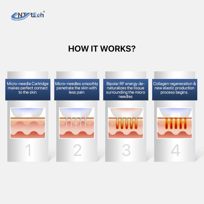Fractional RF Microneedling Machine - Radio Frequency 8 RF Microneedle Device