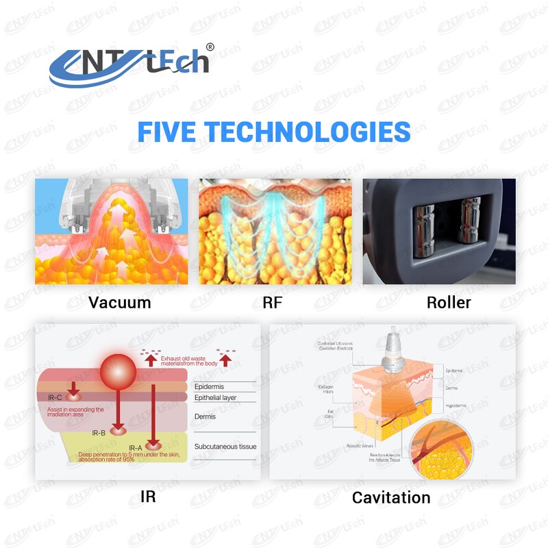 Vela Musehshape Machine - Professional Vacuum Roller Cellulite Massage Therapy